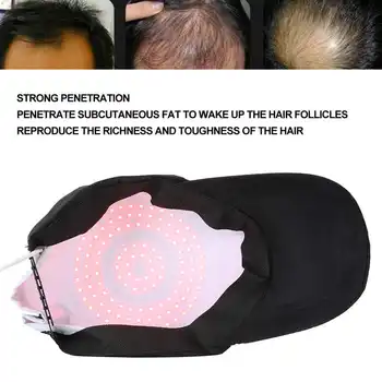 108pcs Lemputė Karoliukai Plaukų Augimą Lazerio Šalmas Terapijos Anti-Hair-Loss Reguliuojamas Plaukų Augimą Bžūp Šviesos Žetonų Plaukų Gydymą Skrybėlę Įrankis