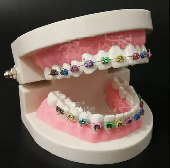 1PC Dantų Ortodontinis Gydymas, dantų Modelį su Orto Metalinis Laikiklis, Arch Vielos Burnos Vamzdelis Ligatura Ryšius & keramikos laikikliai