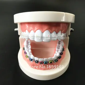 1PC Dantų Ortodontinis Gydymas, dantų Modelį su Orto Metalinis Laikiklis, Arch Vielos Burnos Vamzdelis Ligatura Ryšius & keramikos laikikliai