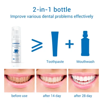 Lanbena balinimas dantų putėsiai burnos higienos pašalinti dėmes, apnašas dantų valymas dantų balta priemonė nauja versija dantys