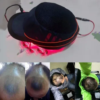 Naujausias 64 /128 Diodų Lazerio Plaukų Augimą Cap Plaukų Slinkimas Gydymo Plaukai Atauga Rengėjas Atauginti Lazerio Šalmas Greitai, Gydymo Skrybėlę