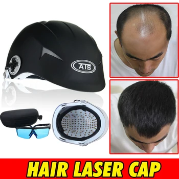 Naujausias 64 /128 Diodų Lazerio Plaukų Augimą Cap Plaukų Slinkimas Gydymo Plaukai Atauga Rengėjas Atauginti Lazerio Šalmas Greitai, Gydymo Skrybėlę