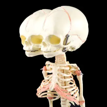 Žmogaus Kūdikiui Deformuojasi Galva Kaukolės Mokslinių Tyrimų Modelį, Skeleto Anatomijos Smegenų Anatomijos Mokymo Studijų Ekranas